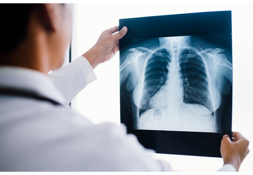Clinician viewing a chest radiograph.