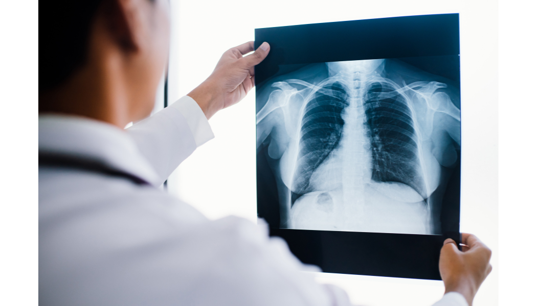 Clinician holding a chest X-ray.