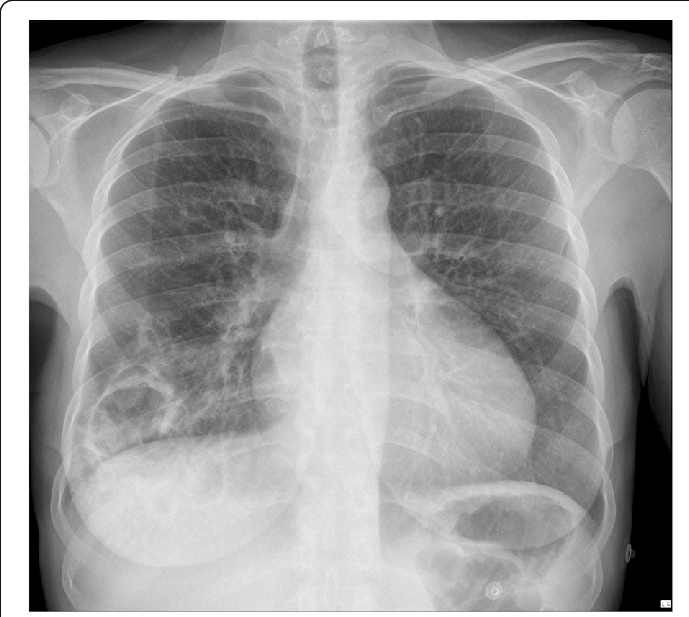 Chest X-ray image.