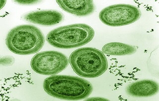 Green oval forms on a pale background.