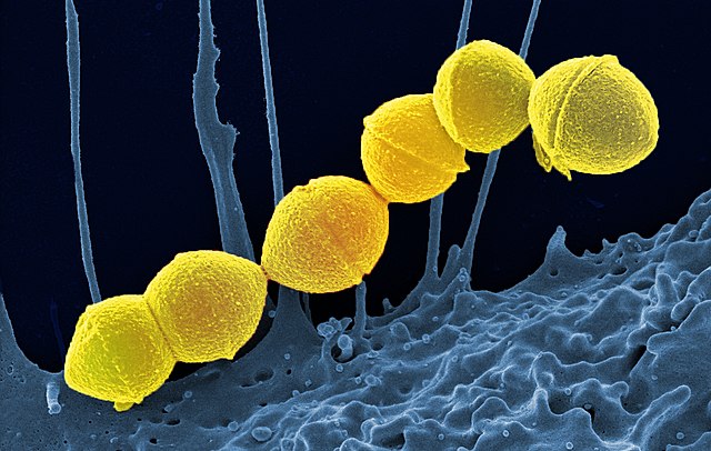 Yellow spherical forms arranged in a chain on a blue textured surface.