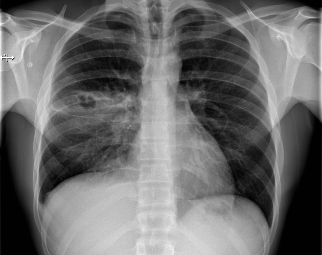 Chest X-ray image.
