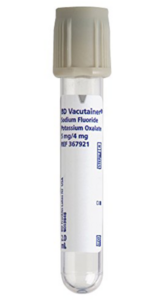 BD Vacutainer tube labeled sodium fluoride.