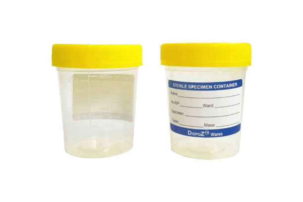 Specimen container with a printed label.