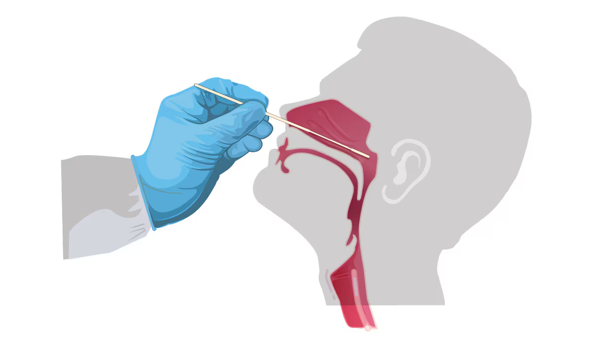 Illustration of nasal-swab collection.