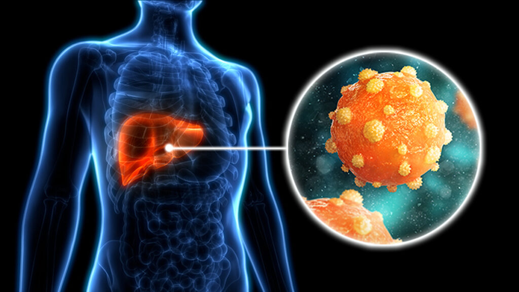 Illustration of a blue human torso with a highlighted liver and an enlarged orange spherical particle.